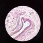 _2